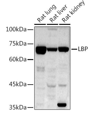 LBP Rabbit Polyclonal Antibody