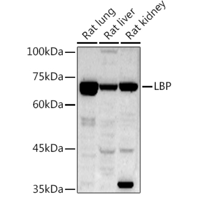 LBP Rabbit Polyclonal Antibody