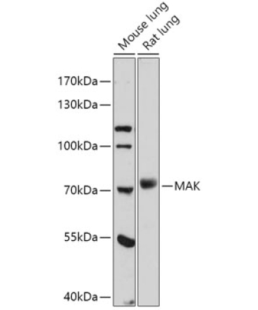 MAK Rabbit Polyclonal Antibody