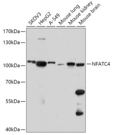 NFATC4 Rabbit Polyclonal Antibody