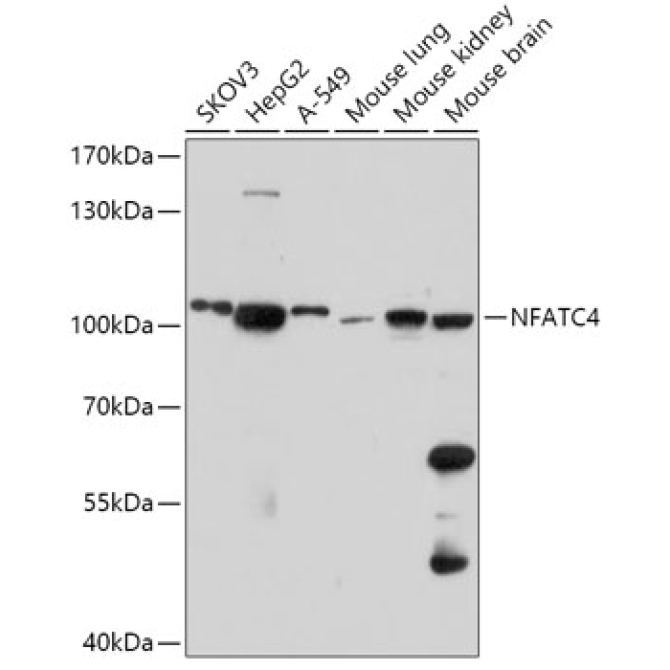 NFATC4 Rabbit Polyclonal Antibody