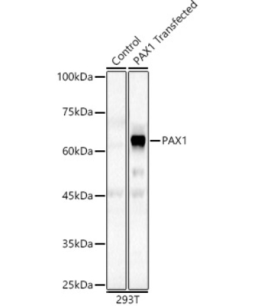 PAX1 Rabbit Polyclonal Antibody