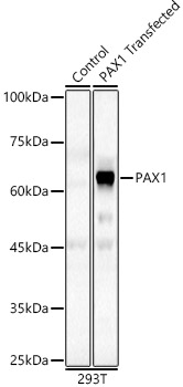 PAX1 Rabbit Polyclonal Antibody