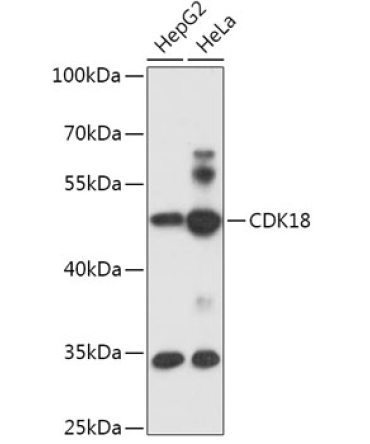 CDK18 Rabbit Polyclonal Antibody