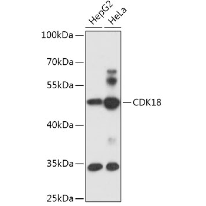 CDK18 Rabbit Polyclonal Antibody