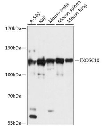 EXOSC10 Rabbit Polyclonal Antibody