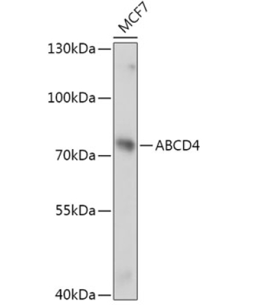 ABCD4 Rabbit Polyclonal Antibody