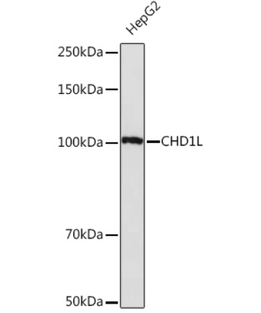 CHD1L Rabbit Monoclonal Antibody