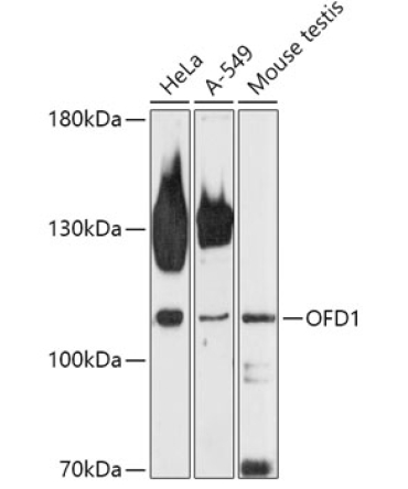 OFD1 Rabbit Polyclonal Antibody