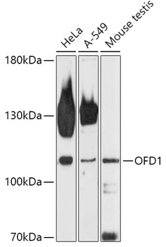 OFD1 Rabbit Polyclonal Antibody