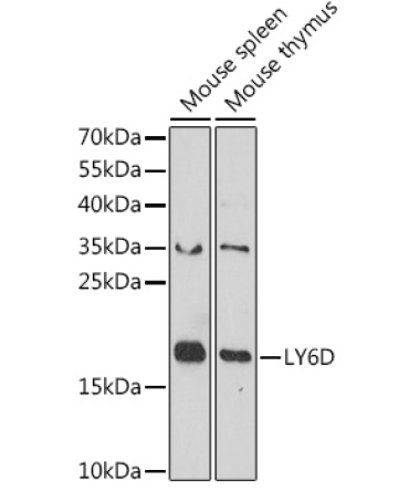 LY6D Rabbit Polyclonal Antibody