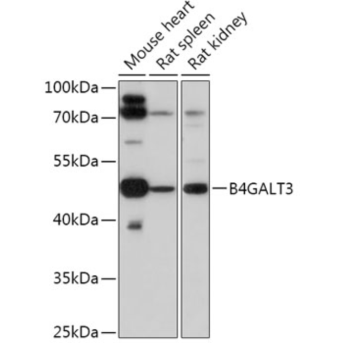 B4GALT3 Rabbit Polyclonal Antibody