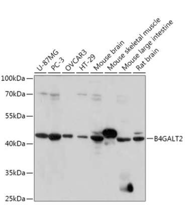B4GALT2 Rabbit Polyclonal Antibody