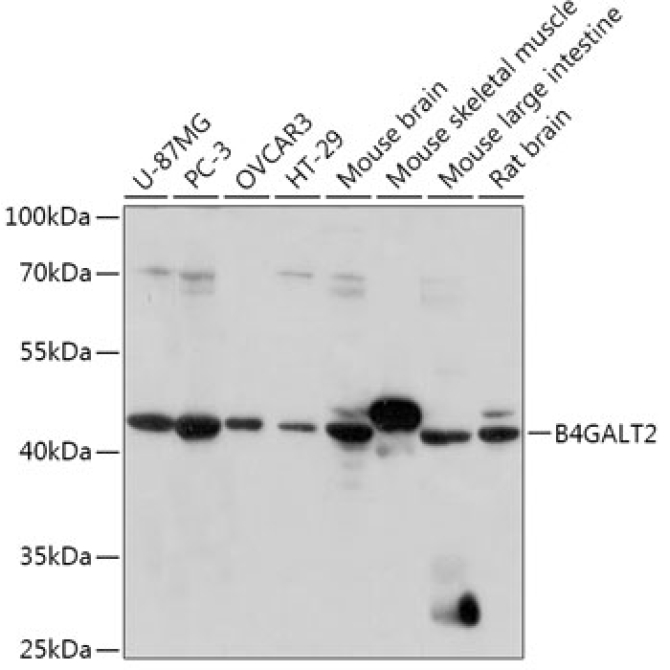 B4GALT2 Rabbit Polyclonal Antibody