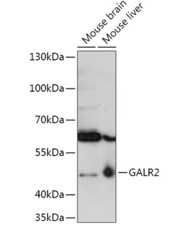 GALR2 Rabbit Polyclonal Antibody