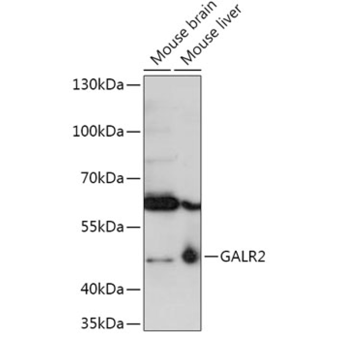 GALR2 Rabbit Polyclonal Antibody