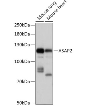 ASAP2 Rabbit Polyclonal Antibody