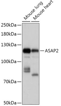 ASAP2 Rabbit Polyclonal Antibody