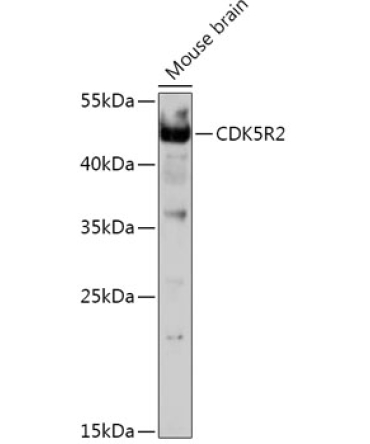 CDK5R2 Rabbit Polyclonal Antibody
