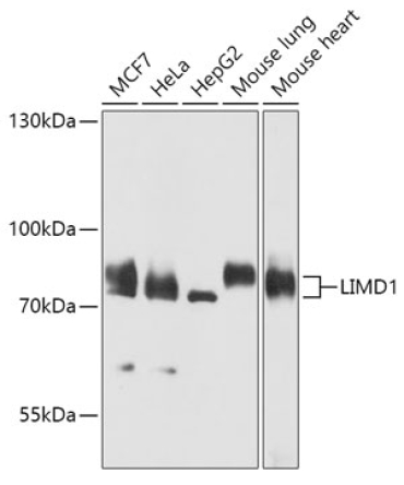 LIMD1 Rabbit Polyclonal Antibody