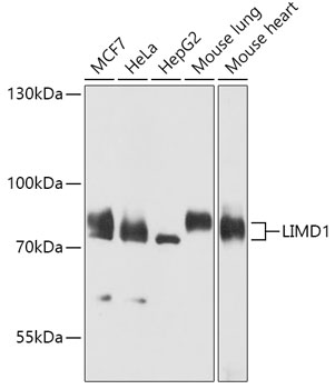 LIMD1 Rabbit Polyclonal Antibody