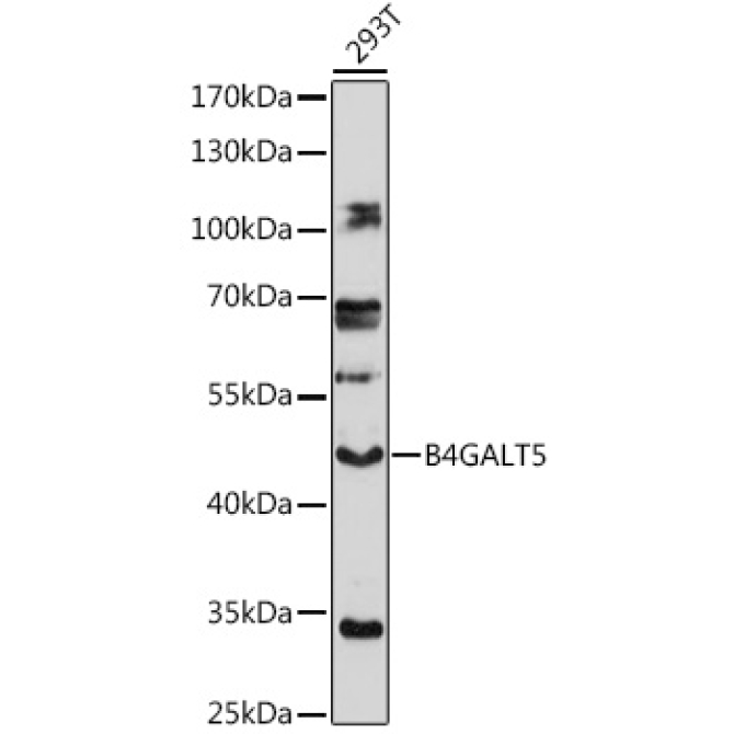 B4GALT5 Rabbit Polyclonal Antibody