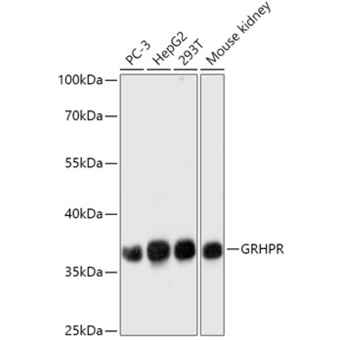 GRHPR Rabbit Polyclonal Antibody
