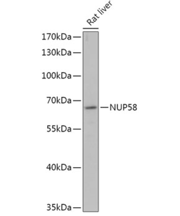 NUP58 Rabbit Polyclonal Antibody