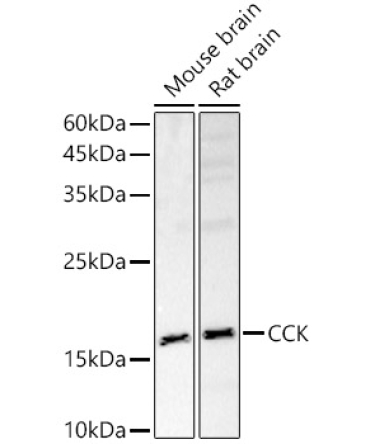 CCK Rabbit Polyclonal Antibody