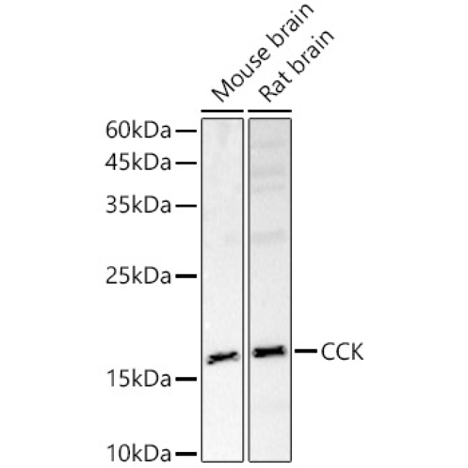 CCK Rabbit Polyclonal Antibody