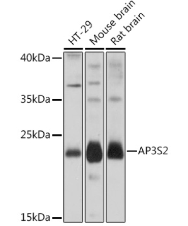 AP3S2 Rabbit Polyclonal Antibody