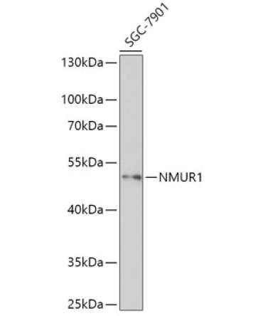 NMUR1 Rabbit Polyclonal Antibody