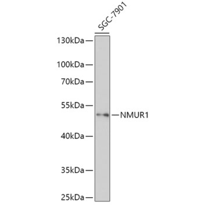NMUR1 Rabbit Polyclonal Antibody