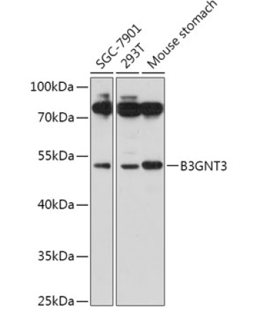 B3GNT3 Rabbit Polyclonal Antibody