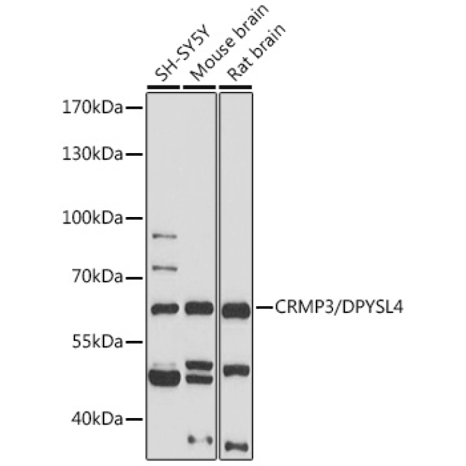 CRMP3/DPYSL4 Rabbit Polyclonal Antibody