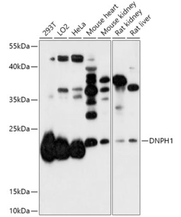 DNPH1 Rabbit Polyclonal Antibody