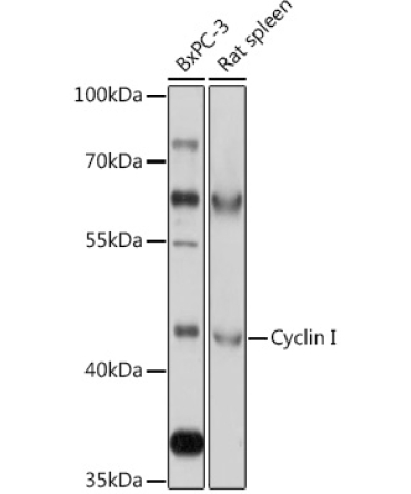 Cyclin I Rabbit Polyclonal Antibody