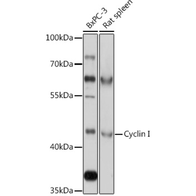 Cyclin I Rabbit Polyclonal Antibody