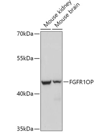 FGFR1OP Rabbit Polyclonal Antibody