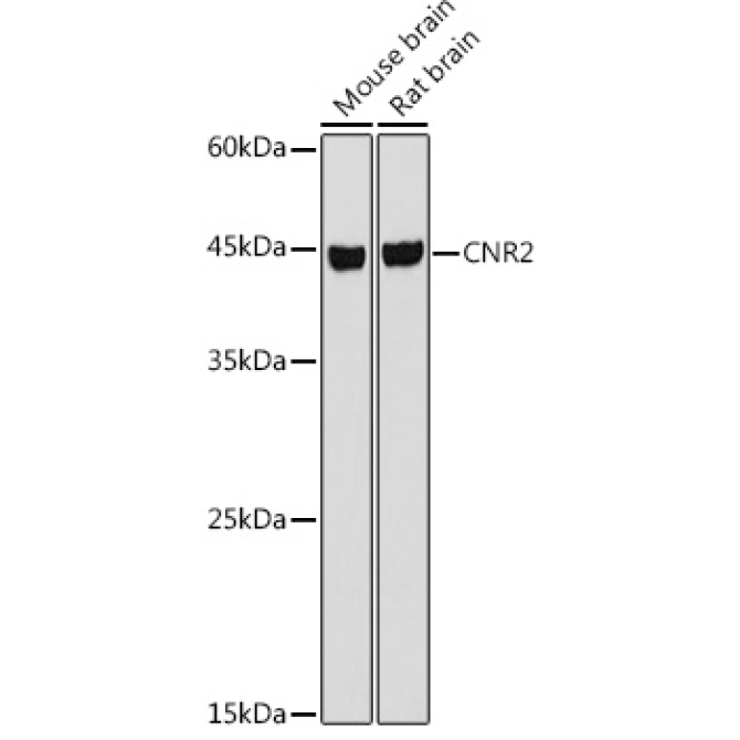 CNR2 Rabbit Polyclonal Antibody