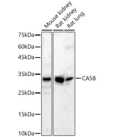 CA5B Rabbit Polyclonal Antibody
