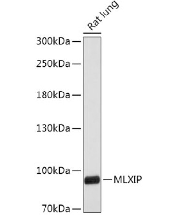 MLXIP Rabbit Polyclonal Antibody