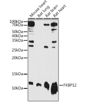 FKBP12 Rabbit Polyclonal Antibody