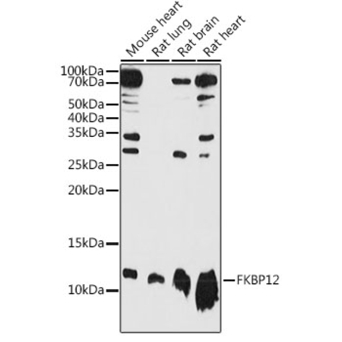 FKBP12 Rabbit Polyclonal Antibody