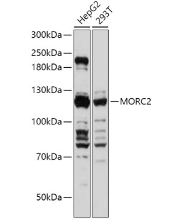 MORC2 Rabbit Polyclonal Antibody