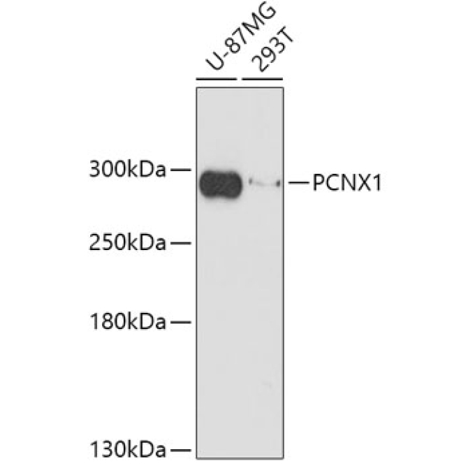 PCNX1 Rabbit Polyclonal Antibody
