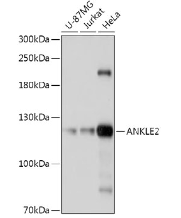 ANKLE2 Rabbit Polyclonal Antibody