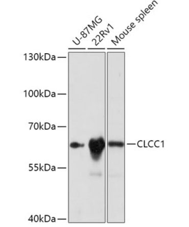 CLCC1 Rabbit Polyclonal Antibody