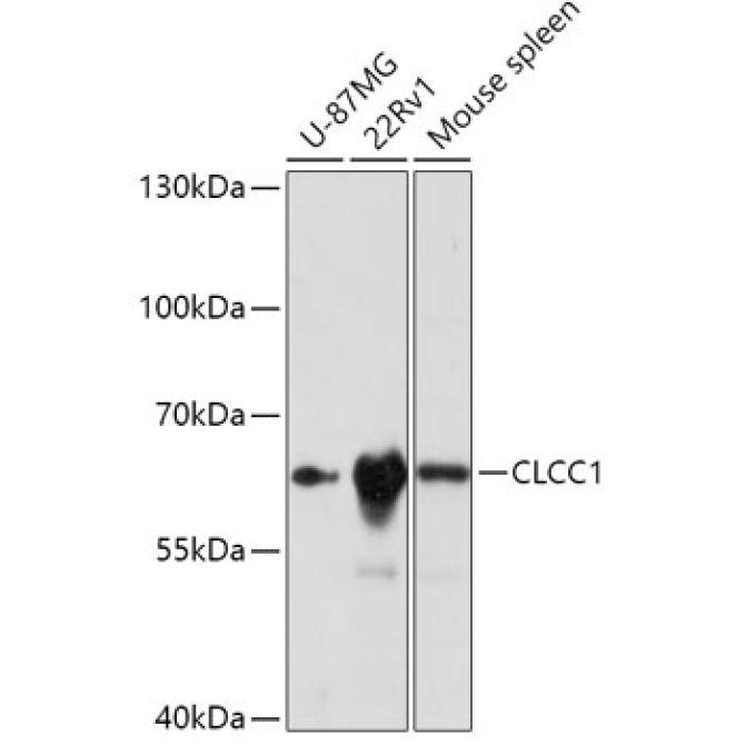 CLCC1 Rabbit Polyclonal Antibody