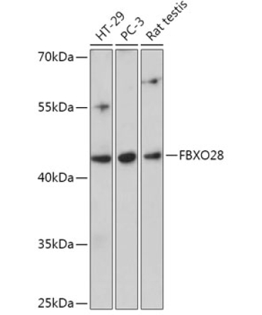 FBXO28 Rabbit Polyclonal Antibody